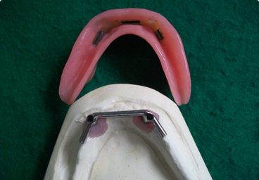 hlddental